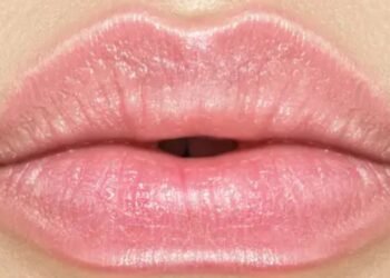 Lip Flip Before and After