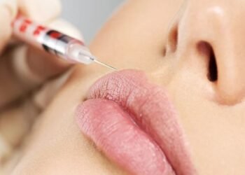 microneedling before and after